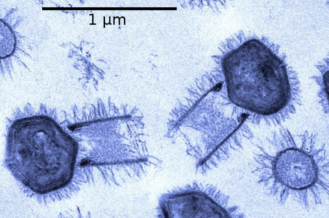 Découverte d’un nouveau virus géant aux propriétés particulièrement originales, le Tupanvirus
