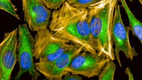 Appel d’offre microscope analyseur dernière génération