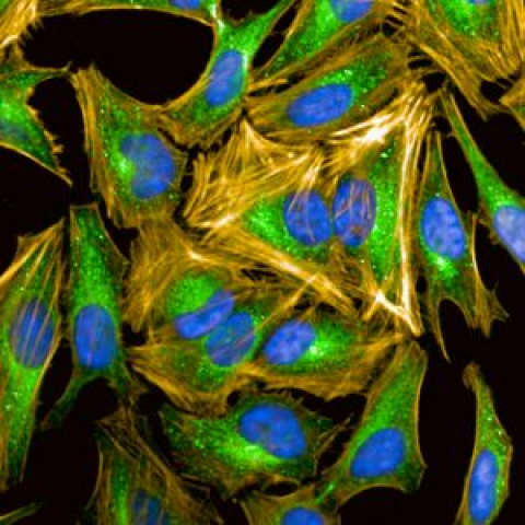 Appel d’offre microscope analyseur dernière génération