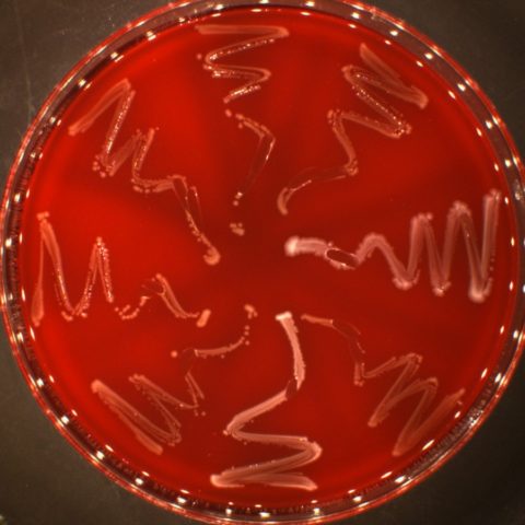 Isolement de 247 nouvelles espèces de bactéries par culturomics à partir du tube digestif humain
