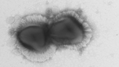 Découverte de l’existence d’un système de défense chez les virus géants