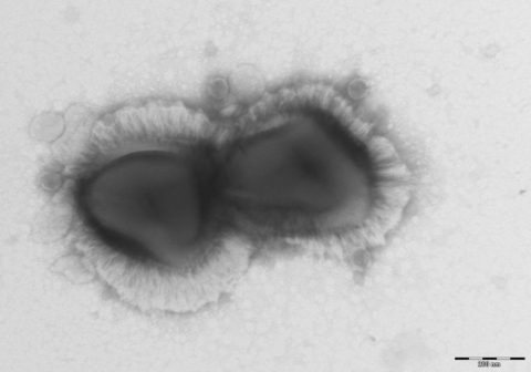 Découverte de l’existence d’un système de défense chez les virus géants