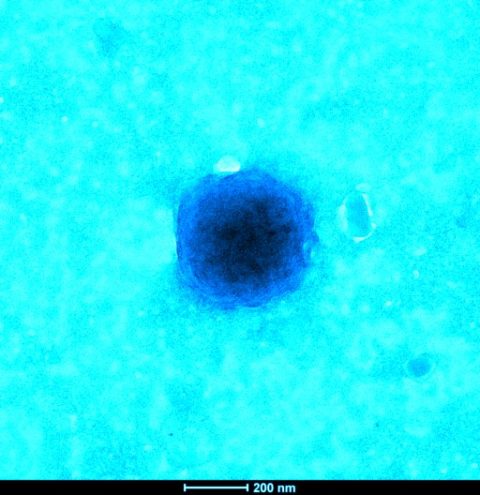 Le coronavirus en photos