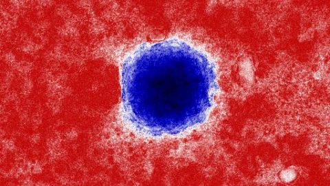 Épidémie à Coronavirus COVID-19
